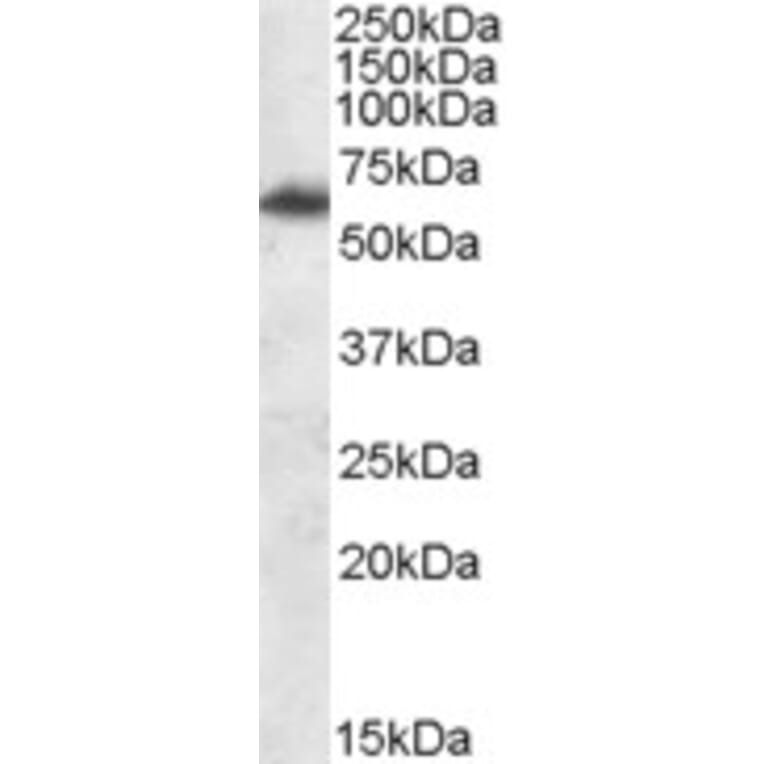 Western Blot - Anti-FTO Antibody (A84524) - Antibodies.com