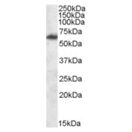 Western Blot - Anti-Fto Antibody (A84524) - Antibodies.com