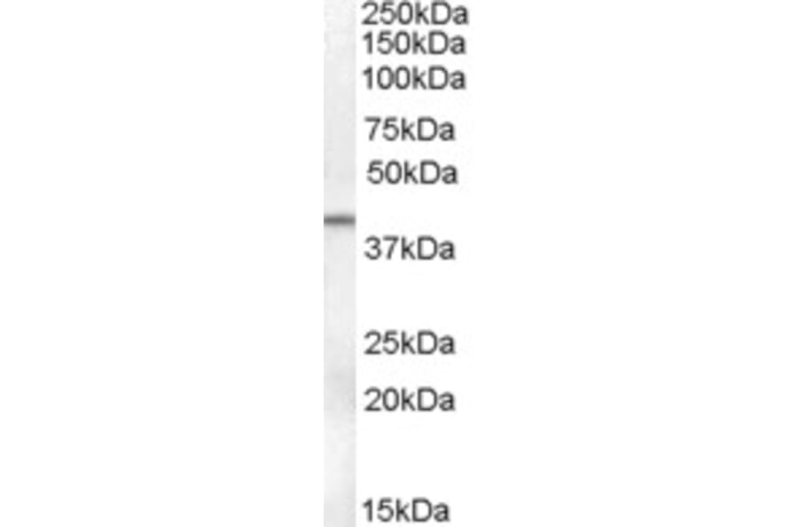 Western Blot - Anti-SerpinB6/CAP Antibody (A84528) - Antibodies.com