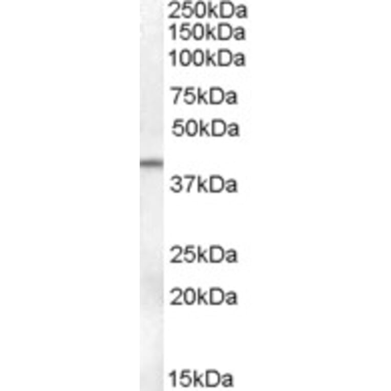 Western Blot - Anti-SerpinB6/CAP Antibody (A84528) - Antibodies.com