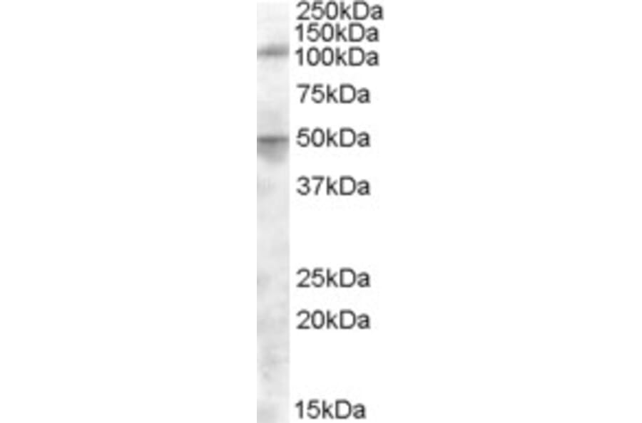 Western Blot - Anti-ERAP2 Antibody (A84529) - Antibodies.com