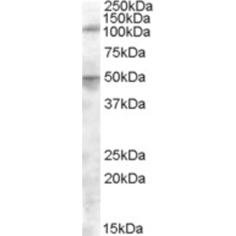 Western Blot - Anti-ERAP2 Antibody (A84529) - Antibodies.com