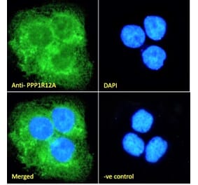 Immunofluorescence - Anti-Myosin Phosphatase Antibody (A84532) - Antibodies.com