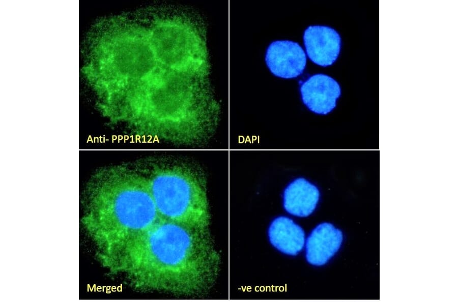 Immunofluorescence - Anti-Myosin Phosphatase Antibody (A84532) - Antibodies.com