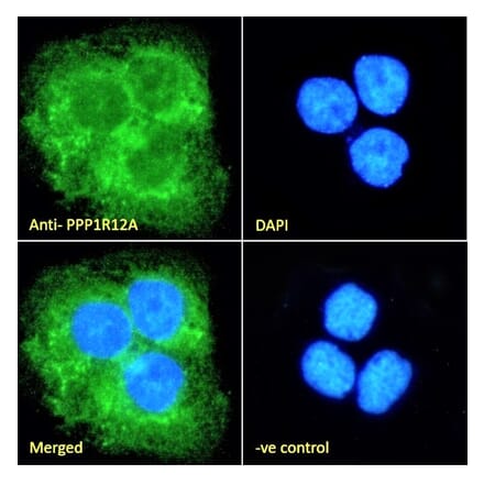 Immunofluorescence - Anti-Myosin Phosphatase Antibody (A84532) - Antibodies.com