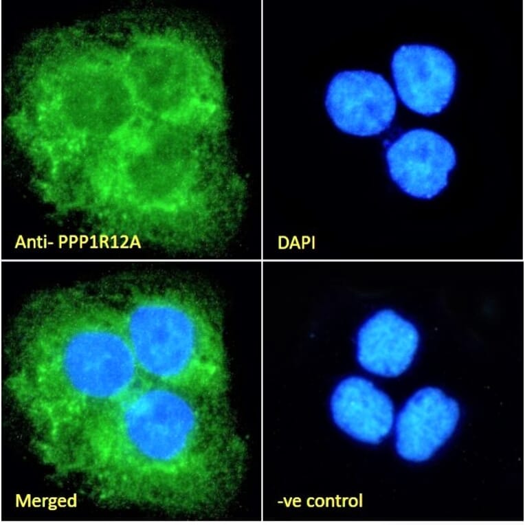Immunofluorescence - Anti-Myosin Phosphatase Antibody (A84532) - Antibodies.com