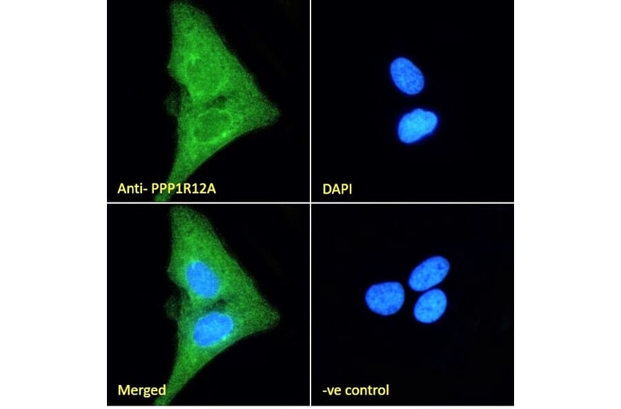 Immunofluorescence - Anti-Myosin Phosphatase Antibody (A84532) - Antibodies.com