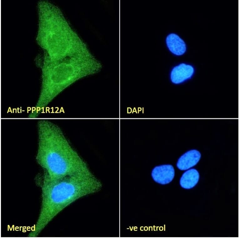 Immunofluorescence - Anti-Myosin Phosphatase Antibody (A84532) - Antibodies.com