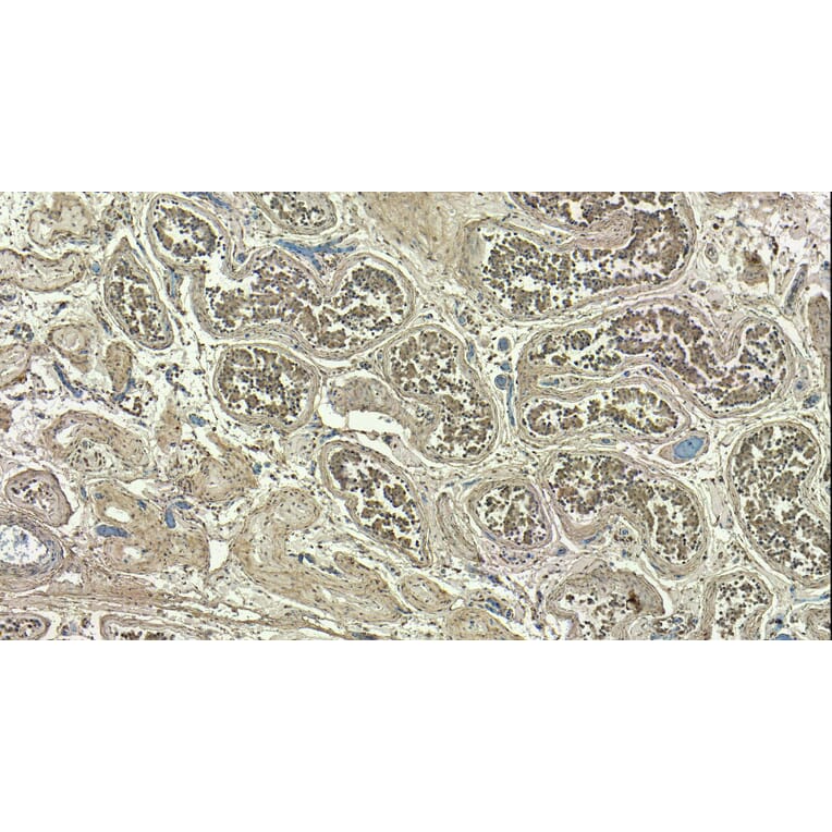 Immunohistochemistry - Anti-Myosin Phosphatase Antibody (A84532) - Antibodies.com