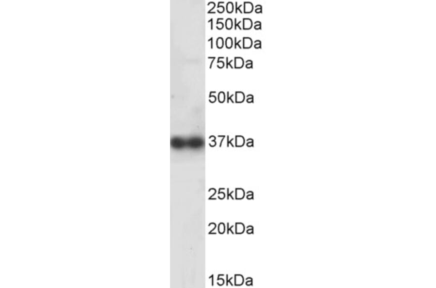 Western Blot - Anti-Cathepsin K Antibody (A84533) - Antibodies.com