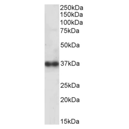 Western Blot - Anti-Cathepsin K Antibody (A84533) - Antibodies.com