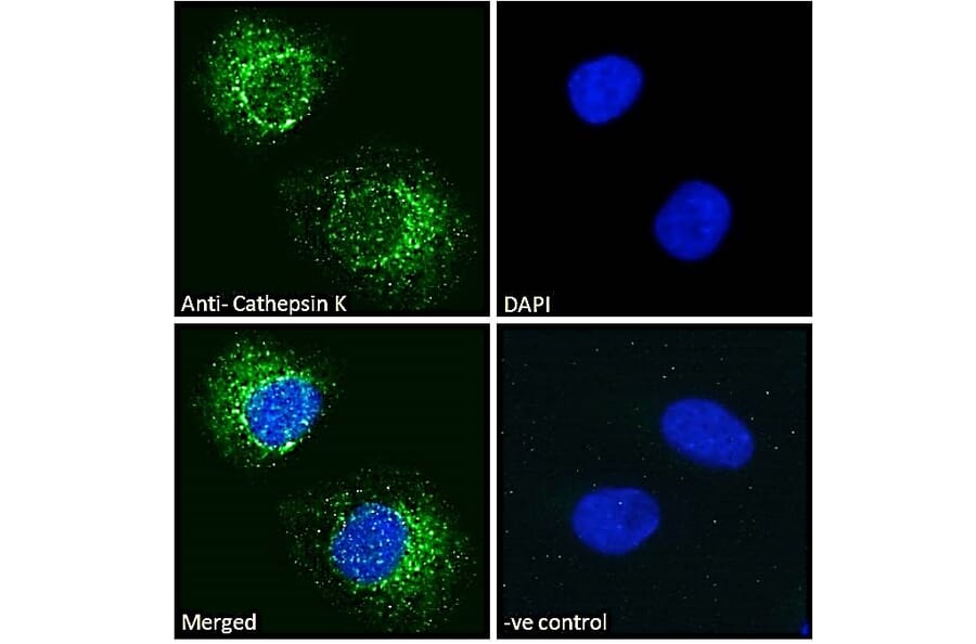 Immunofluorescence - Anti-Cathepsin K Antibody (A84533) - Antibodies.com