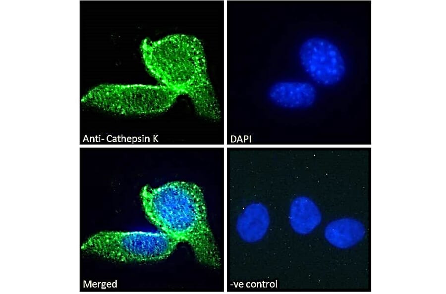 Immunofluorescence - Anti-Cathepsin K Antibody (A84533) - Antibodies.com