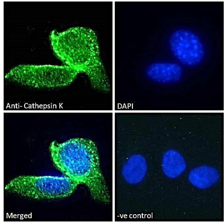 Immunofluorescence - Anti-Cathepsin K Antibody (A84533) - Antibodies.com