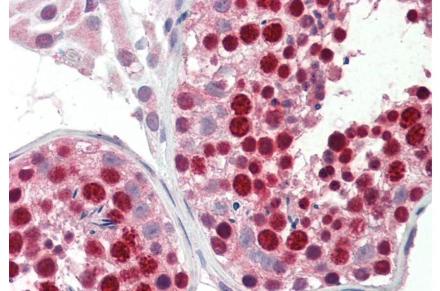 Immunohistochemistry - Anti-ABCA9 Antibody (A84535) - Antibodies.com