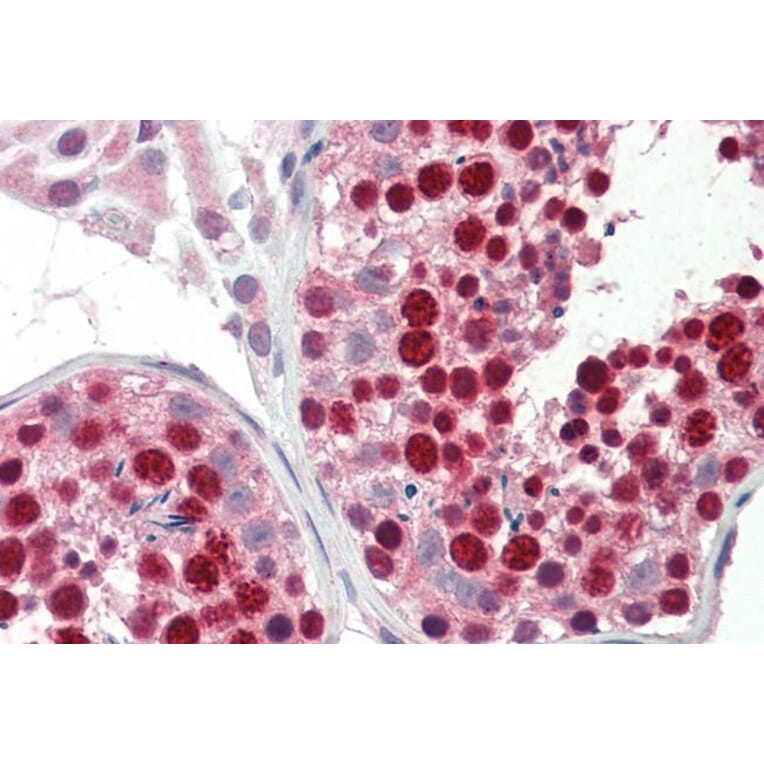 Immunohistochemistry - Anti-ABCA9 Antibody (A84535) - Antibodies.com