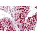 Immunohistochemistry - Anti-ABCA9 Antibody (A84535) - Antibodies.com