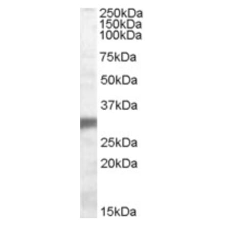 Western Blot - Anti-PHD3 Antibody (A84538) - Antibodies.com