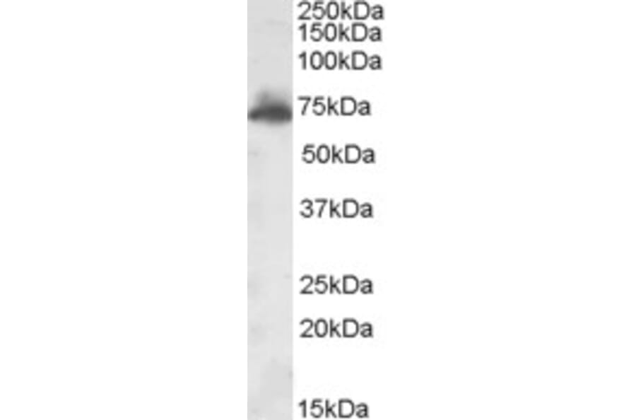 Western Blot - Anti-AKAP10 Antibody (A84539) - Antibodies.com