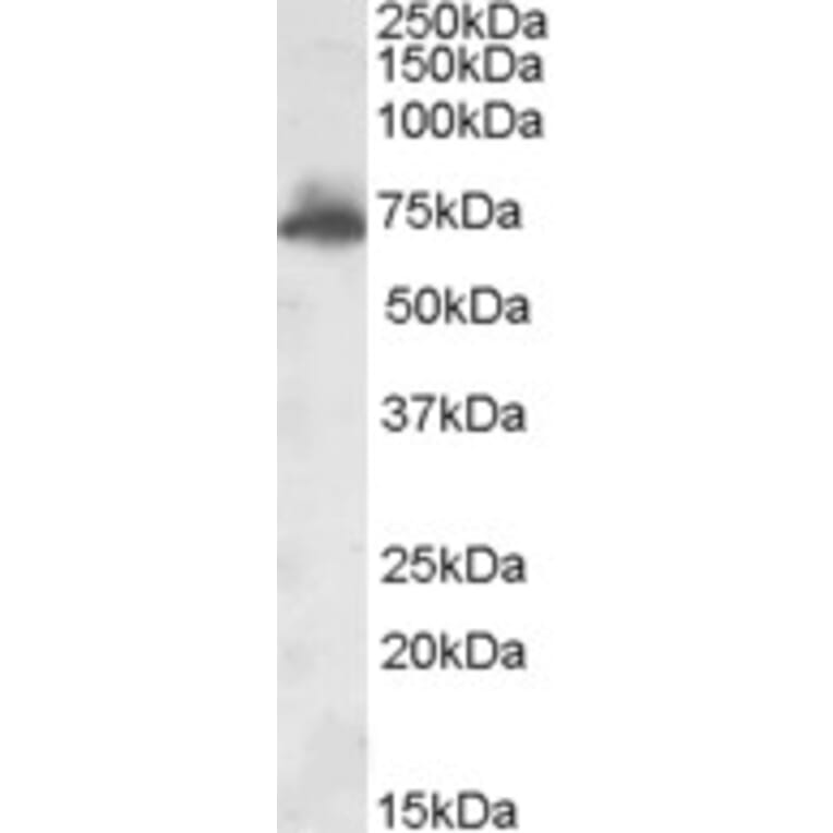 Western Blot - Anti-AKAP10 Antibody (A84539) - Antibodies.com