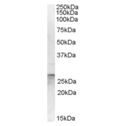 Western Blot - Anti-OTUB2 Antibody (A84541) - Antibodies.com