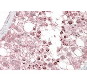 Immunohistochemistry - Anti-USP28 Antibody (A84542) - Antibodies.com