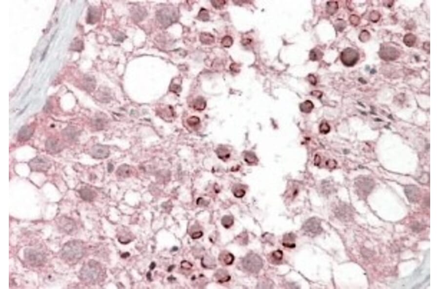 Immunohistochemistry - Anti-USP28 Antibody (A84542) - Antibodies.com