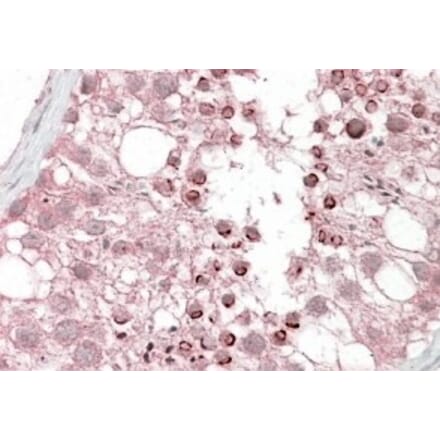 Immunohistochemistry - Anti-USP28 Antibody (A84542) - Antibodies.com