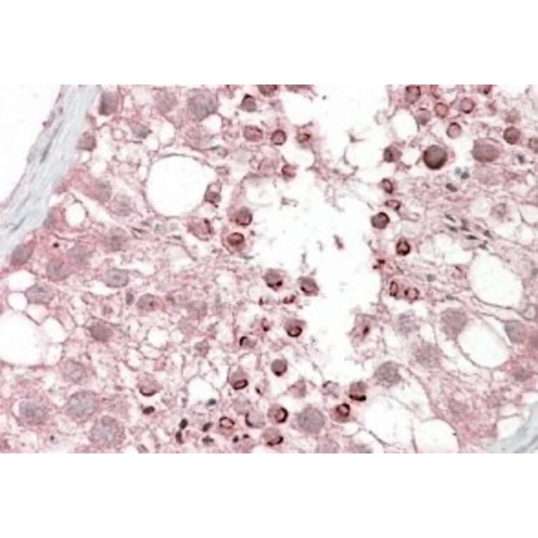 Immunohistochemistry - Anti-USP28 Antibody (A84542) - Antibodies.com