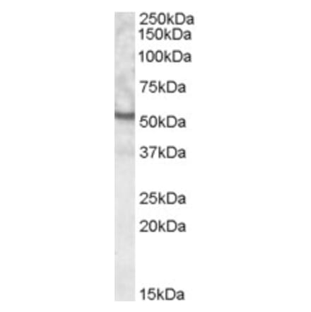 Western Blot - Anti-UNC5CL Antibody (A84544) - Antibodies.com