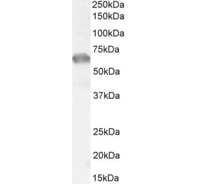 Western Blot - Anti-IRAKM Antibody (A84545) - Antibodies.com