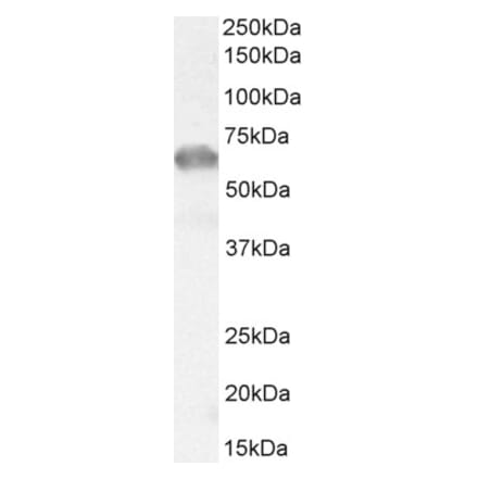 Western Blot - Anti-IRAKM Antibody (A84545) - Antibodies.com