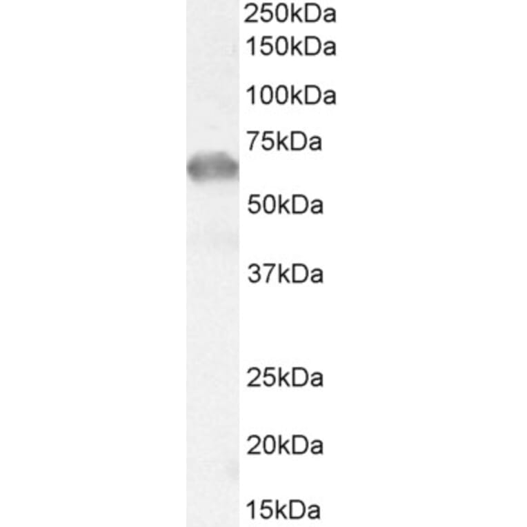 Western Blot - Anti-IRAKM Antibody (A84545) - Antibodies.com