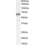 Western Blot - Anti-IRAKM Antibody (A84545) - Antibodies.com