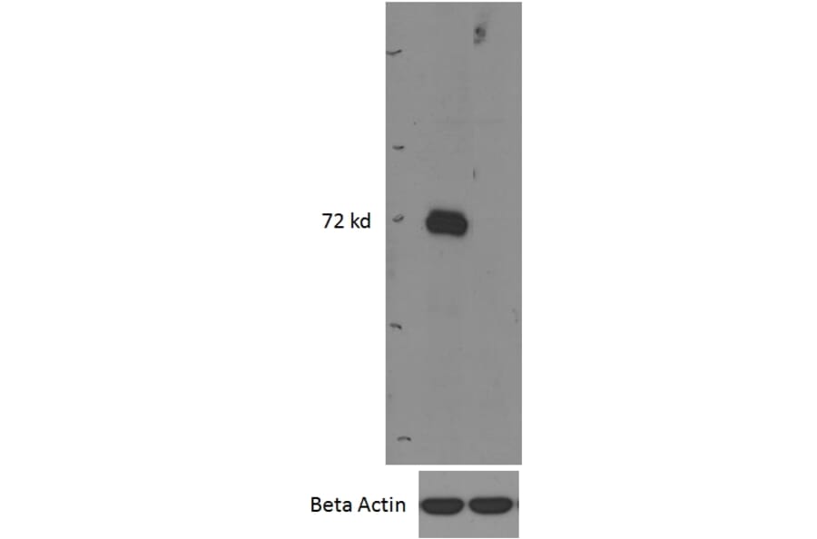 Western Blot - Anti-IRAKM Antibody (A84545) - Antibodies.com