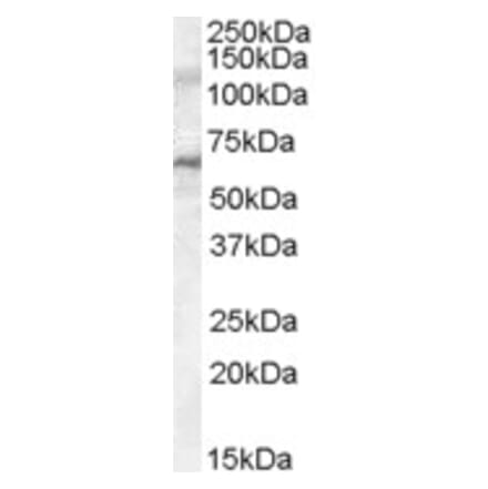 Western Blot - Anti-IRAK3 Antibody (A84545) - Antibodies.com
