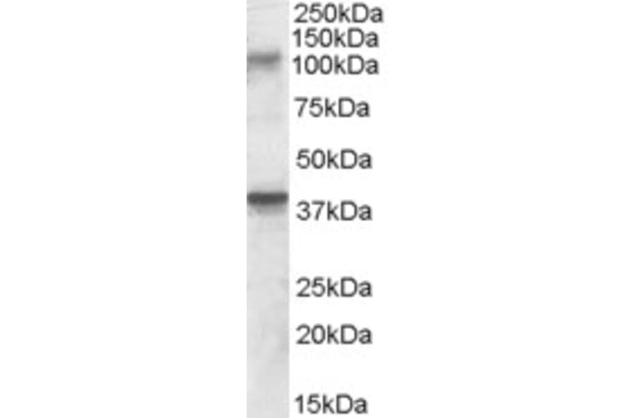 Western Blot - Anti-GRIK3/GluK3 Antibody (A84546) - Antibodies.com