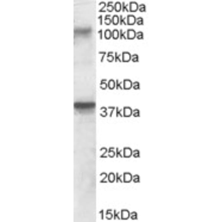 Western Blot - Anti-GRIK3/GluK3 Antibody (A84546) - Antibodies.com