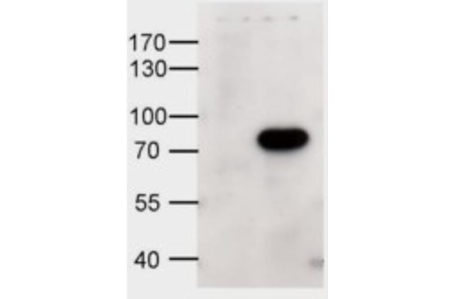 Western Blot - Anti-ABCD1/ALD Antibody (A84547) - Antibodies.com