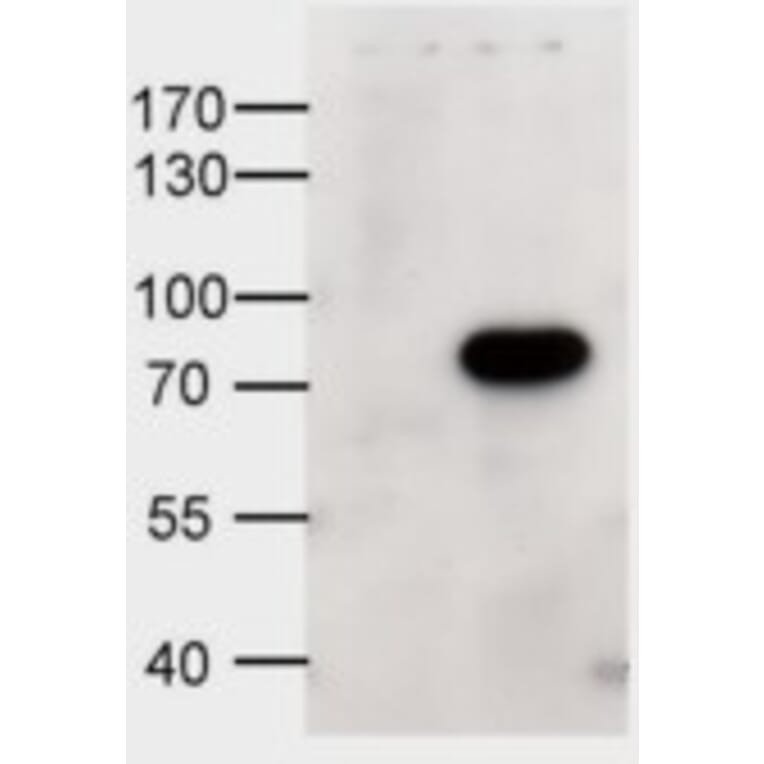 Western Blot - Anti-ABCD1/ALD Antibody (A84547) - Antibodies.com