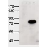 Western Blot - Anti-ABCD1/ALD Antibody (A84547) - Antibodies.com