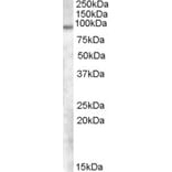 Western Blot - Anti-TCHHL1 Antibody (A84548) - Antibodies.com