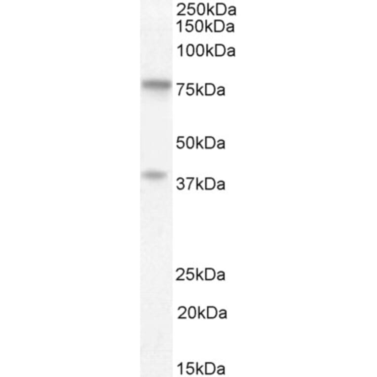 Western Blot - Anti-ZRANB1 Antibody (A84549) - Antibodies.com