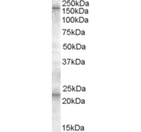 Western Blot - Anti-SUR1 Antibody (A84550) - Antibodies.com