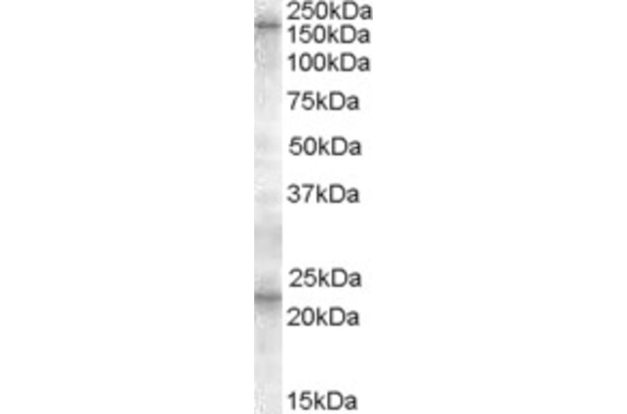 Western Blot - Anti-SUR1 Antibody (A84550) - Antibodies.com
