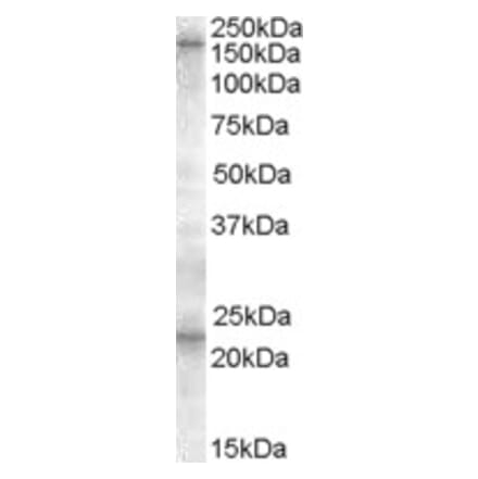 Western Blot - Anti-SUR1 Antibody (A84550) - Antibodies.com