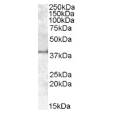 Western Blot - Anti-APOL6 Antibody (A84556) - Antibodies.com