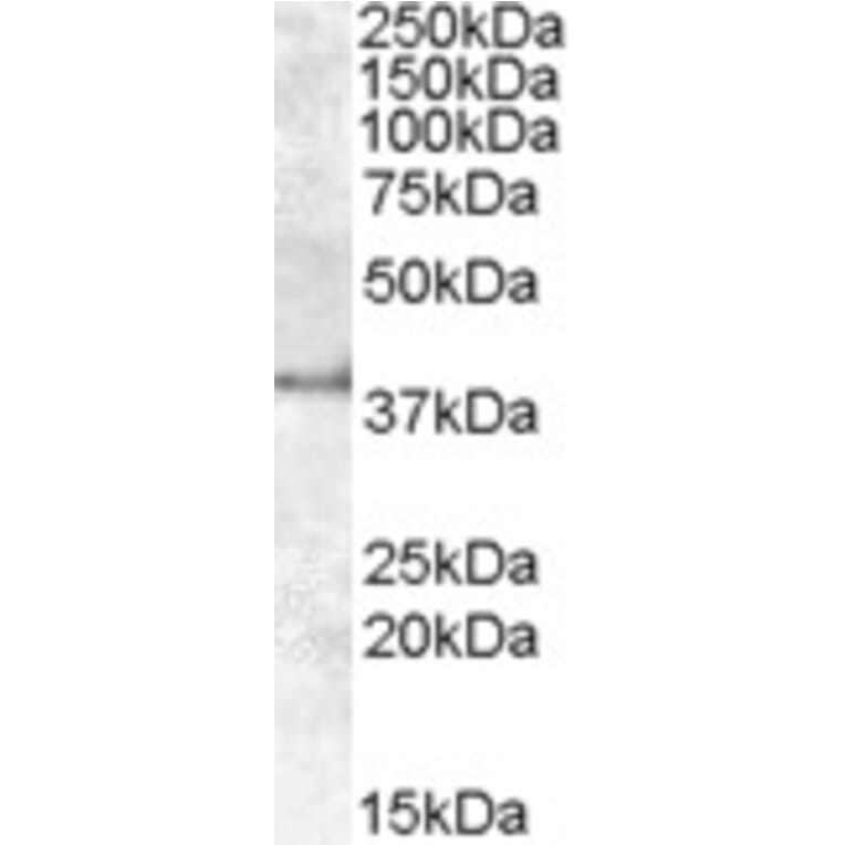 Western Blot - Anti-APOL6 Antibody (A84556) - Antibodies.com