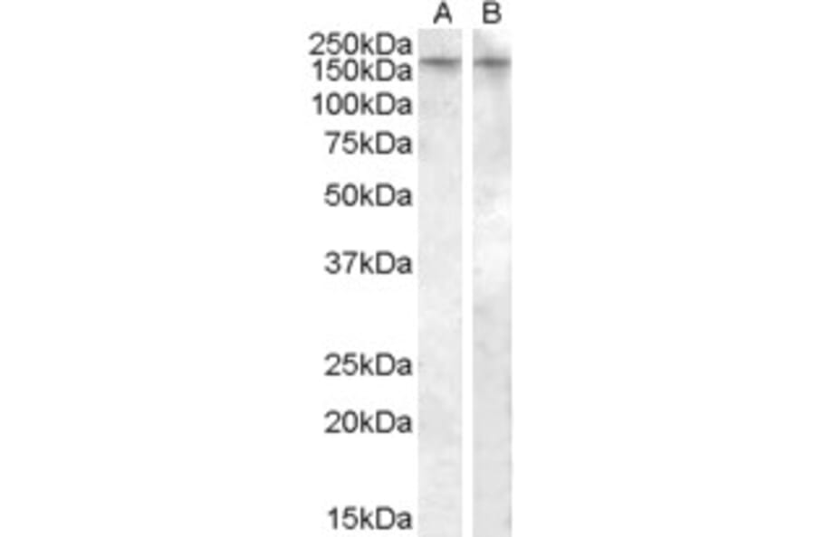 Western Blot - Anti-AVPR1B Antibody (A84559) - Antibodies.com