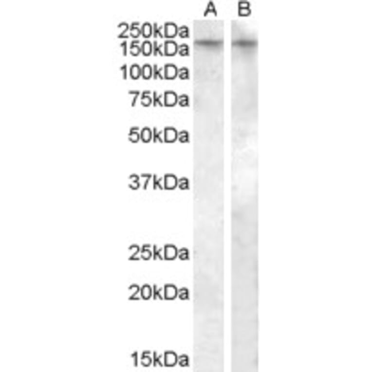 Western Blot - Anti-AVPR1B Antibody (A84559) - Antibodies.com
